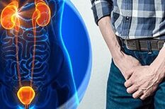 Síntomas de prostatite